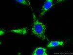C1QBP Antibody in Immunocytochemistry (ICC/IF)