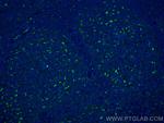 CD68 Antibody in Immunohistochemistry (Paraffin) (IHC (P))