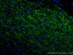 TH Antibody in Immunohistochemistry (Paraffin) (IHC (P))