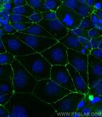 Occludin Antibody in Immunocytochemistry (ICC/IF)