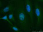 LYN Antibody in Immunocytochemistry (ICC/IF)
