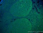 IL-28A Antibody in Immunohistochemistry (Paraffin) (IHC (P))