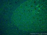 IL-28A Antibody in Immunohistochemistry (Paraffin) (IHC (P))
