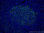 IL-19 Antibody in Immunohistochemistry (Paraffin) (IHC (P))