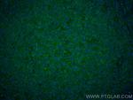CD45 Antibody in Immunohistochemistry (Paraffin) (IHC (P))