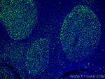 IL-36 Beta/IL-1F8 Antibody in Immunohistochemistry (Paraffin) (IHC (P))