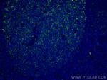 IL-36 Beta/IL-1F8 Antibody in Immunohistochemistry (Paraffin) (IHC (P))