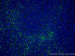 IL-2 Antibody in Immunohistochemistry (Paraffin) (IHC (P))