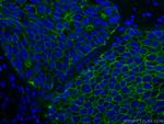 E-cadherin Antibody in Immunohistochemistry (Paraffin) (IHC (P))