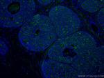 E-cadherin Antibody in Immunohistochemistry (Paraffin) (IHC (P))