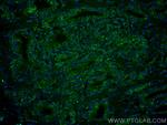 Prostein Antibody in Immunohistochemistry (Paraffin) (IHC (P))