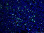 DYKDDDDK Antibody in Immunocytochemistry (ICC/IF)