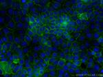 GNAS Antibody in Immunocytochemistry (ICC/IF)