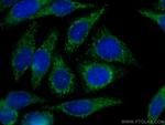 Alpha 1B-Glycoprotein Antibody in Immunocytochemistry (ICC/IF)