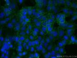 EPCAM/CD326 Antibody in Immunocytochemistry (ICC/IF)