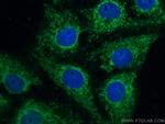 SFRP2 Antibody in Immunocytochemistry (ICC/IF)