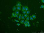 MMP2 Antibody in Immunocytochemistry (ICC/IF)