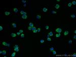 NDP52 Antibody in Immunocytochemistry (ICC/IF)