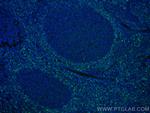 HVCN1 Antibody in Immunohistochemistry (Paraffin) (IHC (P))