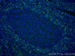 HVCN1 Antibody in Immunohistochemistry (Paraffin) (IHC (P))