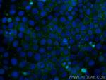 ZO-1 Antibody in Immunocytochemistry (ICC/IF)
