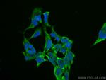 AP5Z1/SPG48 Antibody in Immunocytochemistry (ICC/IF)