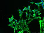 PHD2/EGLN1 Antibody in Immunocytochemistry (ICC/IF)