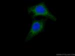 AKR7A2 Antibody in Immunocytochemistry (ICC/IF)