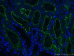 ACE2 Antibody in Immunohistochemistry (Paraffin) (IHC (P))
