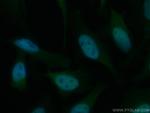 RBX1 Antibody in Immunocytochemistry (ICC/IF)