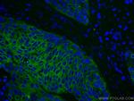 Cytokeratin 5 Antibody in Immunohistochemistry (Paraffin) (IHC (P))