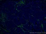 Collagen Type VI Antibody in Immunohistochemistry (Paraffin) (IHC (P))