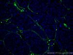 Collagen Type VI Antibody in Immunohistochemistry (Paraffin) (IHC (P))