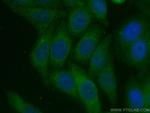 APOE Antibody in Immunocytochemistry (ICC/IF)