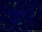S100A8 Antibody in Immunohistochemistry (Paraffin) (IHC (P))