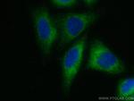 INF2 Antibody in Immunocytochemistry (ICC/IF)