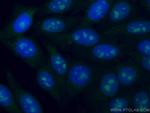 DDX21 Antibody in Immunocytochemistry (ICC/IF)