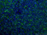 CD40 Antibody in Immunohistochemistry (Paraffin) (IHC (P))