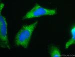 hIST1 Antibody in Immunocytochemistry (ICC/IF)