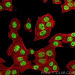 Cyclin H Antibody in Immunocytochemistry (ICC/IF)