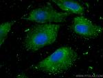 RAB3D Antibody in Immunocytochemistry (ICC/IF)