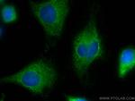 URG4 Antibody in Immunocytochemistry (ICC/IF)