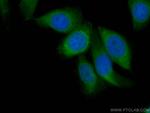 ENO1 Antibody in Immunocytochemistry (ICC/IF)