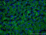 GCK Antibody in Immunohistochemistry (Paraffin) (IHC (P))
