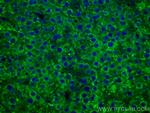 FUCA1 Antibody in Immunohistochemistry (Paraffin) (IHC (P))