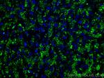 CD107a/LAMP1 Antibody in Immunohistochemistry (Paraffin) (IHC (P))