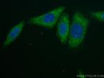 Alpha 2-Antiplasmin Antibody in Immunocytochemistry (ICC/IF)