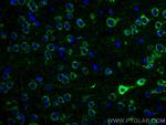 Alpha SNAP Antibody in Immunohistochemistry (Paraffin) (IHC (P))