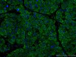 ANAPC5 Antibody in Immunohistochemistry (Paraffin) (IHC (P))