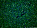 PPP4R1 Antibody in Immunohistochemistry (Paraffin) (IHC (P))